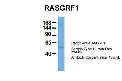 Western Blot: RASGRF1 Antibody [NBP2-85603]