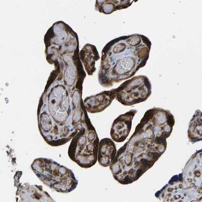 Immunohistochemistry-Paraffin: RASGRF2 Antibody [NBP1-83331]