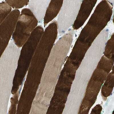 Immunohistochemistry-Paraffin: RASGRP2 Antibody [NBP1-86661]