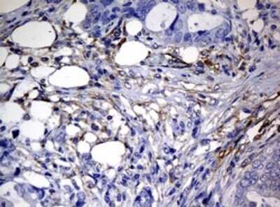 Immunohistochemistry: RASGRP3 Antibody (OTI2C11) [NBP2-45528]