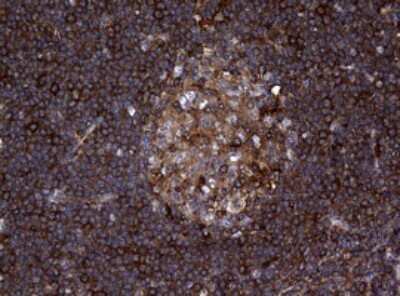 Immunohistochemistry: RASGRP3 Antibody (OTI2C11) [NBP2-45528]