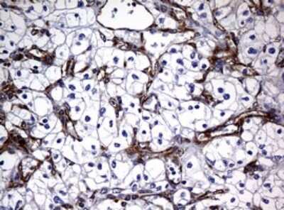 Immunohistochemistry: RASGRP3 Antibody (OTI2C11) [NBP2-45528]