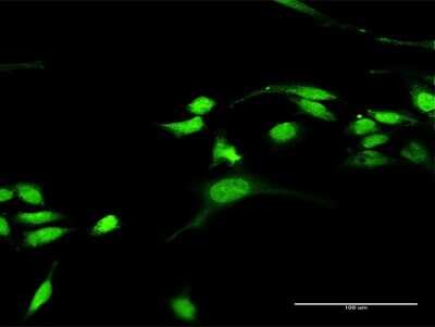 Immunocytochemistry/ Immunofluorescence: RASGRP3 Antibody [H00025780-D01P]