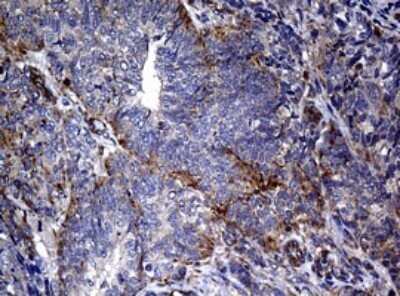 Immunohistochemistry: RASGRP3 Antibody (OTI2C11) - Azide and BSA Free [NBP2-73812]