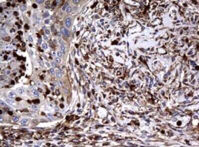 Immunohistochemistry: RASGRP3 Antibody (OTI2C11) - Azide and BSA Free [NBP2-73812]