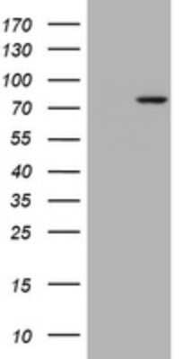 Western Blot: RASGRP3 Antibody (OTI2C11)Azide and BSA Free [NBP2-73812]