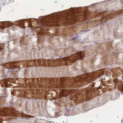 Immunohistochemistry-Paraffin: RASL10B Antibody [NBP2-13205]