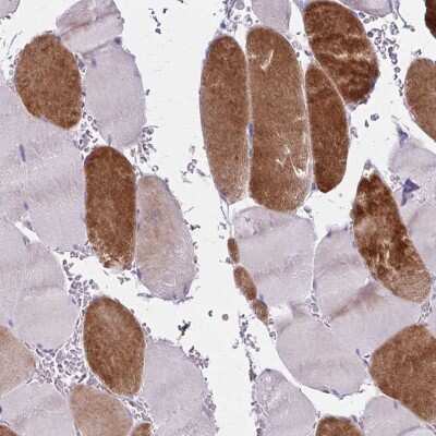 Immunohistochemistry-Paraffin: RASL10B Antibody [NBP2-38817]