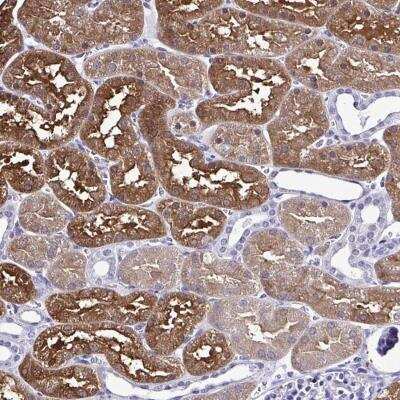 Immunohistochemistry-Paraffin: RASL11B Antibody [NBP2-31695]