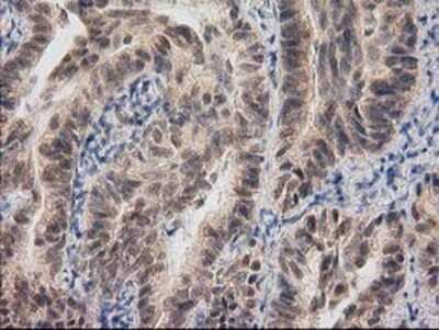 Immunohistochemistry-Paraffin: RASSF1 Antibody (OTI2B11) [NBP2-03644]