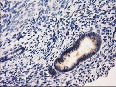 Immunohistochemistry-Paraffin: RASSF1 Antibody (OTI2B11) [NBP2-03644]