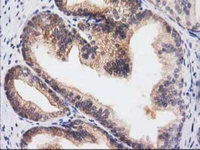 Immunohistochemistry-Paraffin: RASSF1 Antibody (OTI2B11) [NBP2-03644]