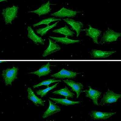 Immunocytochemistry/ Immunofluorescence: RASSF1 Antibody (3F3) - BSA Free [NBP1-04342]