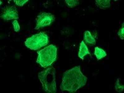 Immunocytochemistry/ Immunofluorescence: RASSF1 Antibody (OTI2B11) - Azide and BSA Free [NBP2-73786]