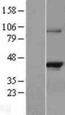 Western Blot: RASSF1 Overexpression Lysate [NBL1-15176]