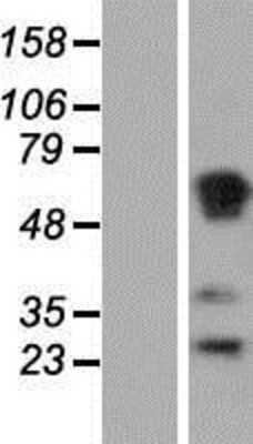 Western Blot: RASSF1 Overexpression Lysate [NBP2-10015]