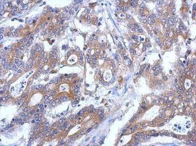 Immunohistochemistry-Paraffin: RASSF4 Antibody [NBP2-20090]