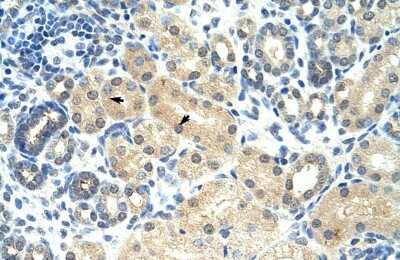 Immunohistochemistry: RASSF7 Antibody [NBP2-88128]