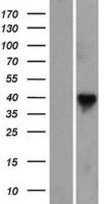 Western Blot: RASSF7 Overexpression Lysate [NBP2-08005]
