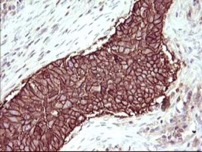 Immunohistochemistry: RASSF8 Antibody (OTI1F5) [NBP2-45530]