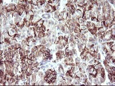 Immunohistochemistry: RASSF8 Antibody (OTI1F5) [NBP2-45530]