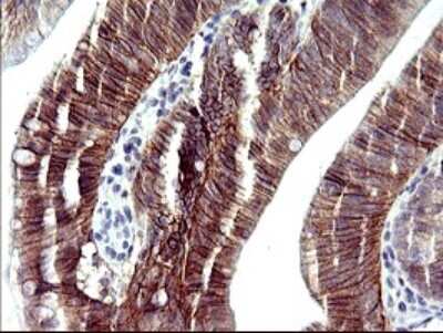 Immunohistochemistry: RASSF8 Antibody (OTI1F5) [NBP2-45530]
