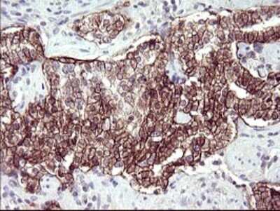 Immunohistochemistry: RASSF8 Antibody (OTI1F5) [NBP2-45530]