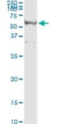 Immunoprecipitation: RASSF8 Antibody (2G1) [H00011228-M01]