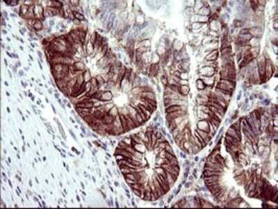 Immunohistochemistry: RASSF8 Antibody (OTI1F5) - Azide and BSA Free [NBP2-73820]