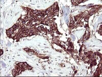Immunohistochemistry: RASSF8 Antibody (OTI1F5) - Azide and BSA Free [NBP2-73820]