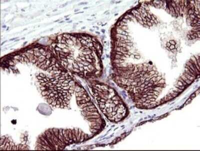 Immunohistochemistry: RASSF8 Antibody (OTI1F5) - Azide and BSA Free [NBP2-73820]