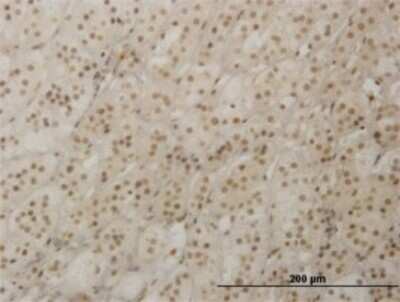 Immunohistochemistry-Paraffin: RAX Antibody (4F4) [H00030062-M02]