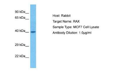 Western Blot: RAX Antibody [NBP2-86764]