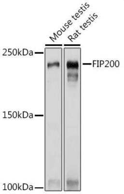 Western Blot: RB1CC1 AntibodyAzide and BSA Free [NBP2-93785]