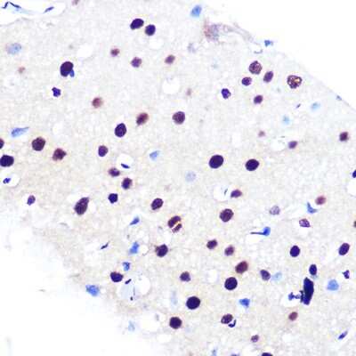 Immunohistochemistry-Paraffin: RBBP4/RbAp48 Antibody (0D1X1) [NBP3-16237]