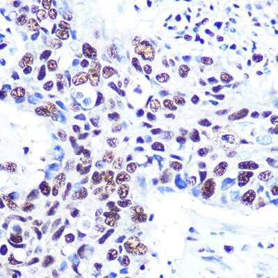 Immunohistochemistry-Paraffin: RBBP4/RbAp48 Antibody (0D1X1) [NBP3-16237]