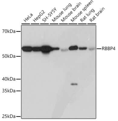 Western Blot: RBBP4/RbAp48 Antibody (0D1X1) [NBP3-16237]