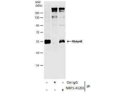 Immunoprecipitation: RBBP4/RbAp48 Antibody (13D10) [NBP1-41201]