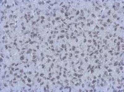 Immunohistochemistry: RBBP4/RbAp48 Antibody (15G12) [NBP1-41202]
