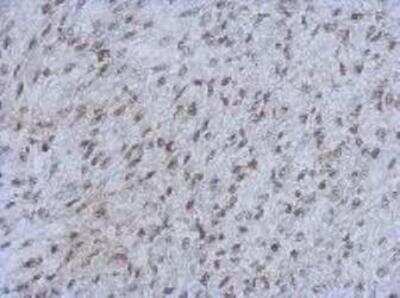 Immunohistochemistry: RBBP4/RbAp48 Antibody (15G12) [NBP1-41202]
