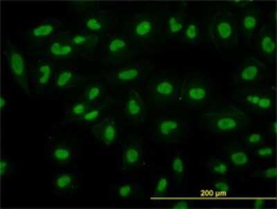 Immunocytochemistry/ Immunofluorescence: RBBP4/RbAp48 Antibody (2D7) [H00005928-M01]