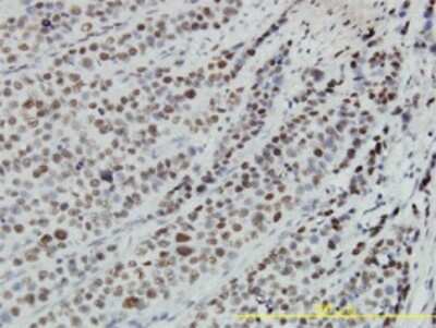 Immunohistochemistry-Paraffin: RBBP4/RbAp48 Antibody (2D7) [H00005928-M01]