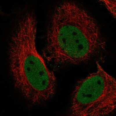 Immunocytochemistry/ Immunofluorescence: RBBP4/RbAp48 Antibody [NBP2-56286]