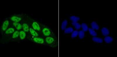Immunocytochemistry/ Immunofluorescence: RBBP4/RbAp48 Antibody (JU37-47) [NBP2-75642]