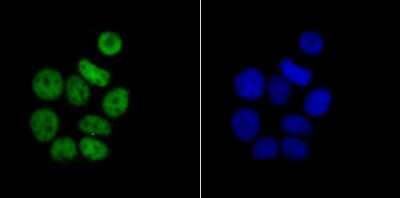 Immunocytochemistry/ Immunofluorescence: RBBP4/RbAp48 Antibody (JU37-47) [NBP2-75642]