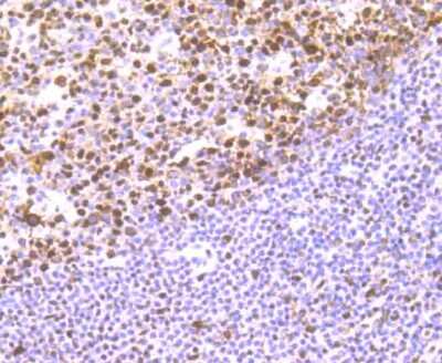 Immunohistochemistry-Paraffin: RBBP4/RbAp48 Antibody (JU37-47) [NBP2-75642]