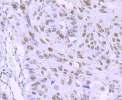 Immunohistochemistry-Paraffin: RBBP4/RbAp48 Antibody (JU37-47) [NBP2-75642]
