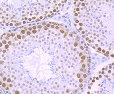 Immunohistochemistry-Paraffin: RBBP4/RbAp48 Antibody (JU37-47) [NBP2-75642]