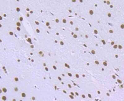 Immunohistochemistry-Paraffin: RBBP4/RbAp48 Antibody (JU37-47) [NBP2-75642]