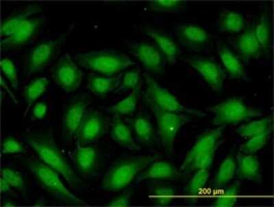 Immunocytochemistry/ Immunofluorescence: RBBP9 Antibody (2A11) [H00010741-M01]